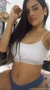 Colombianamputee #0tOQrYhY