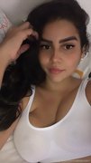 Colombianamputee #GhGNTfsH