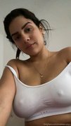 Colombianamputee #O7VKC8OT